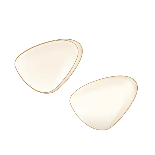 オールセラミックインレー